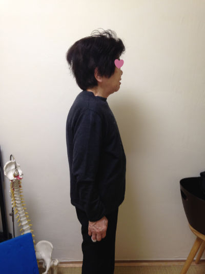 治療後2、1か月後